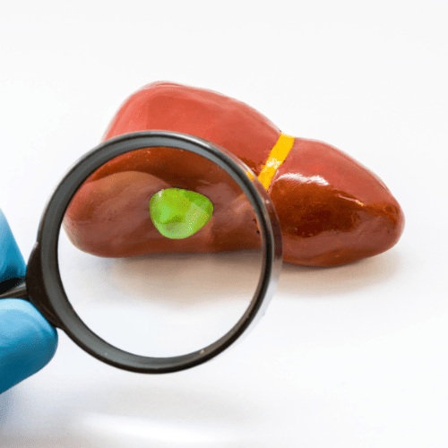 especialista-en-vesicula-cdmx-cerca